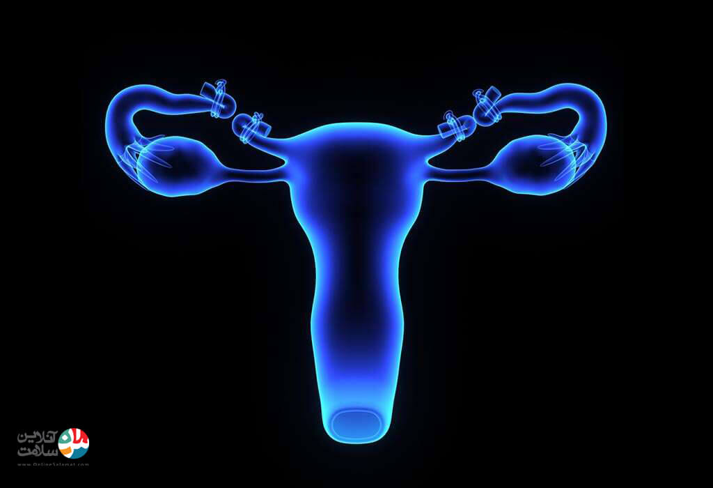 روش جراحی بستن لوله های رحمی ( توبکتومی)