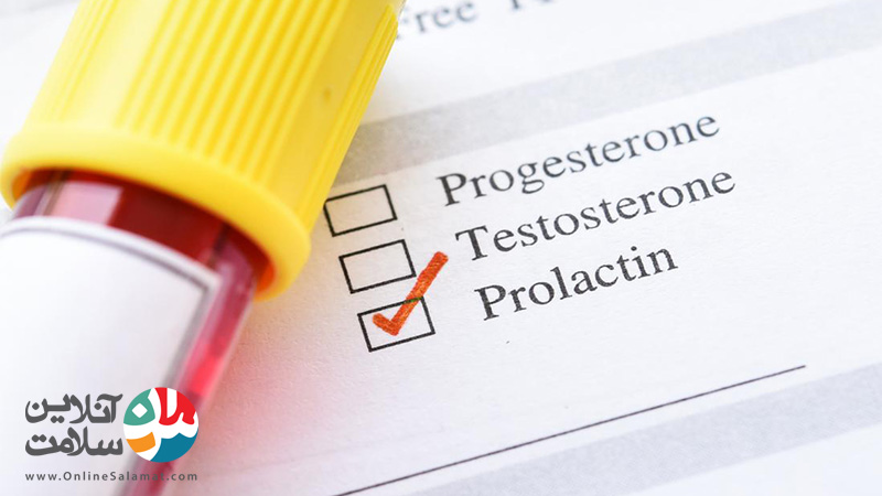 آزمایش تست پرولاکتین
